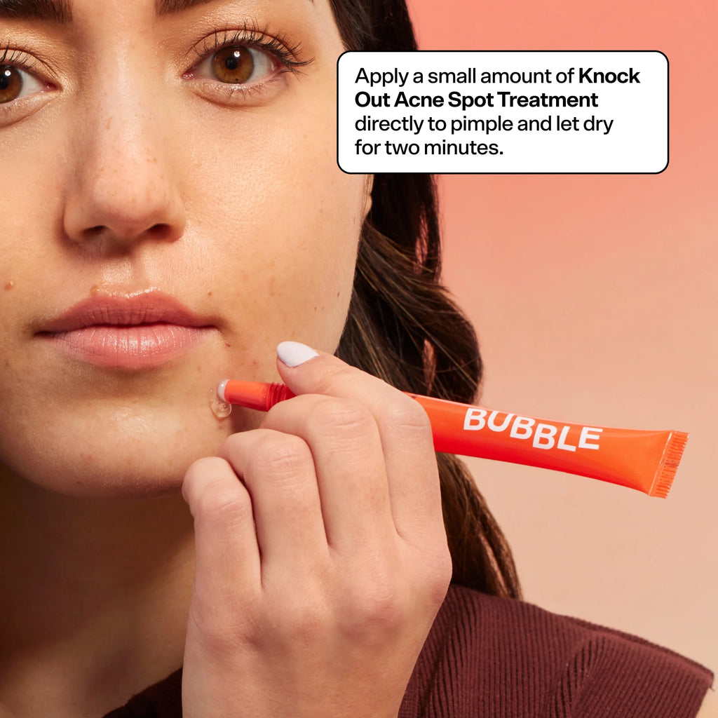 Acne Kit, 3 Items Z653712