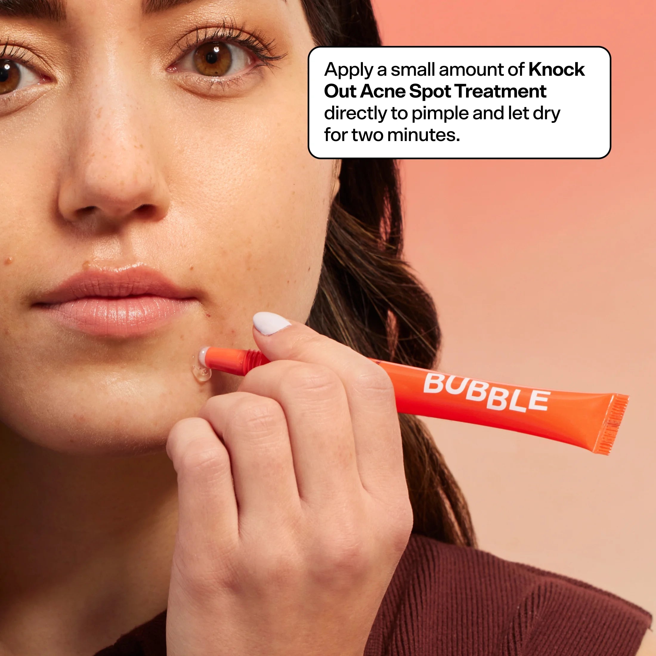 Acne Kit, 3 Items Z653712