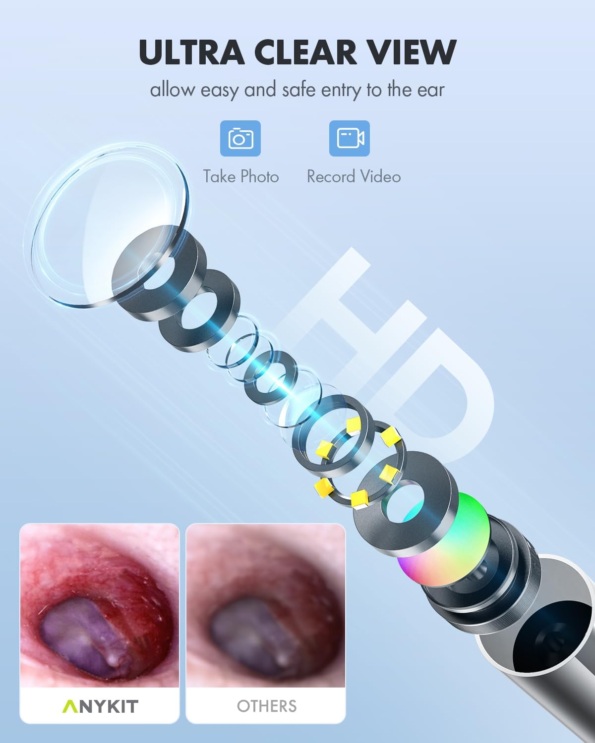 HD Ultra Clear View Ear Wax Removal Tool Otoscope with Ear Spoon T439